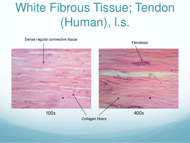 Passing tissue during miscarriage