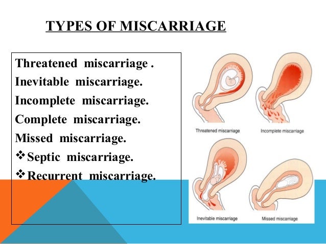 Miscarriage pain at 5 weeks