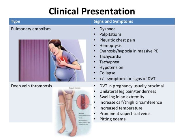 Is congestion a pregnancy symptom