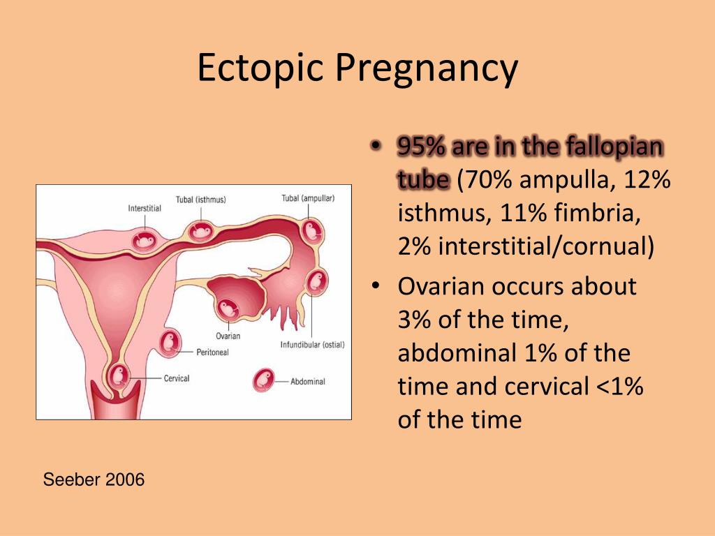 Cervical pain pregnancy