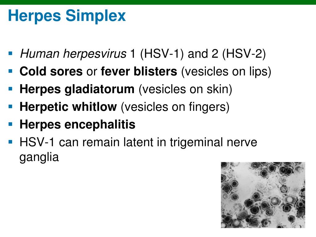 Herpes simplex 1 и 2