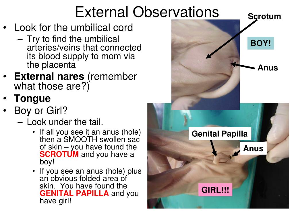 When should umbilical stump fall off