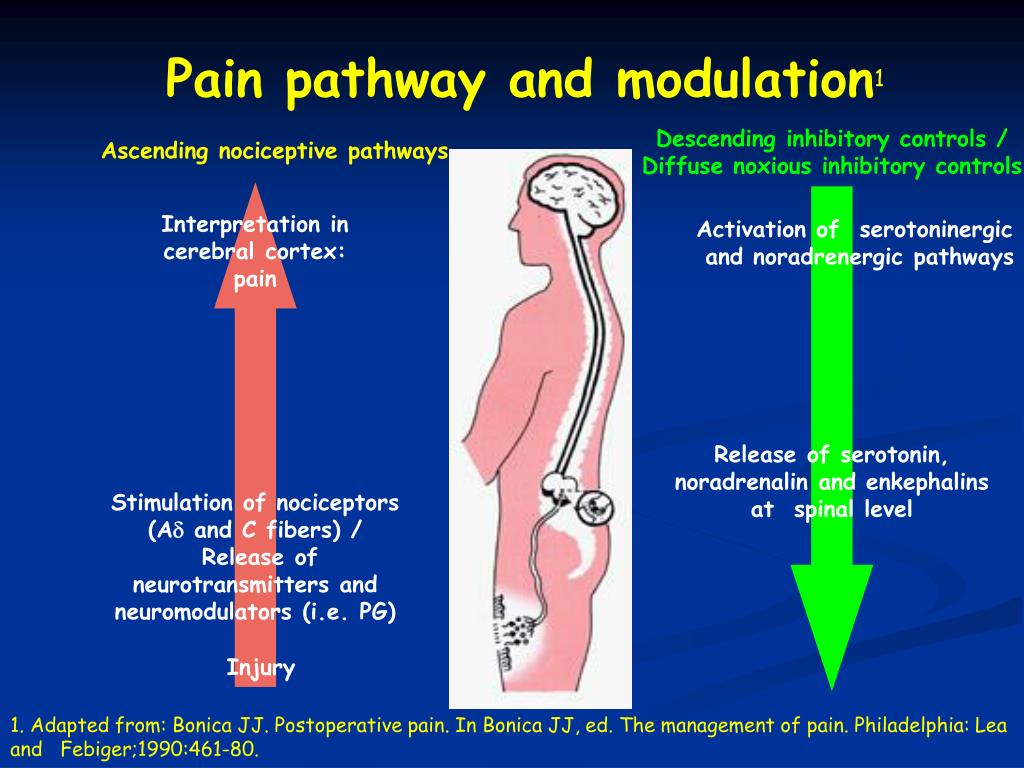 Managing pain during labor naturally