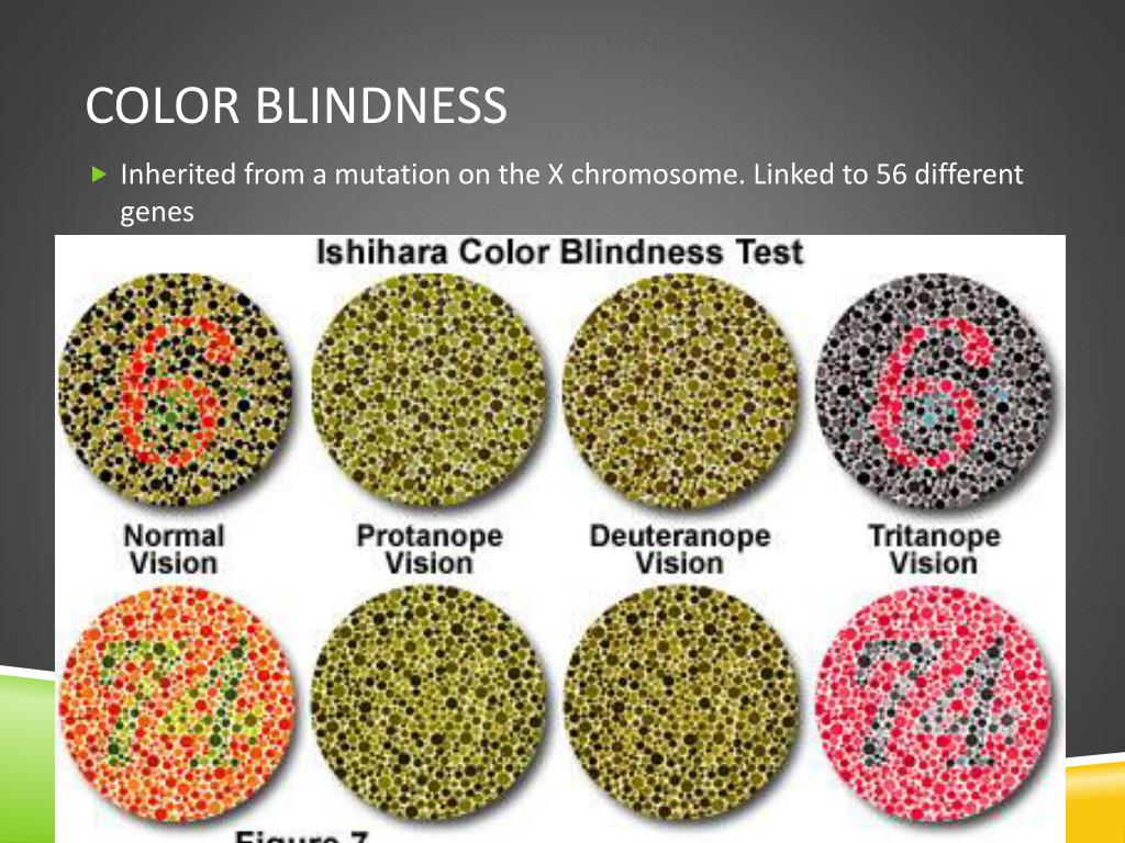 What causes blindness at birth