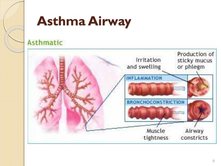 Are you born with asthma