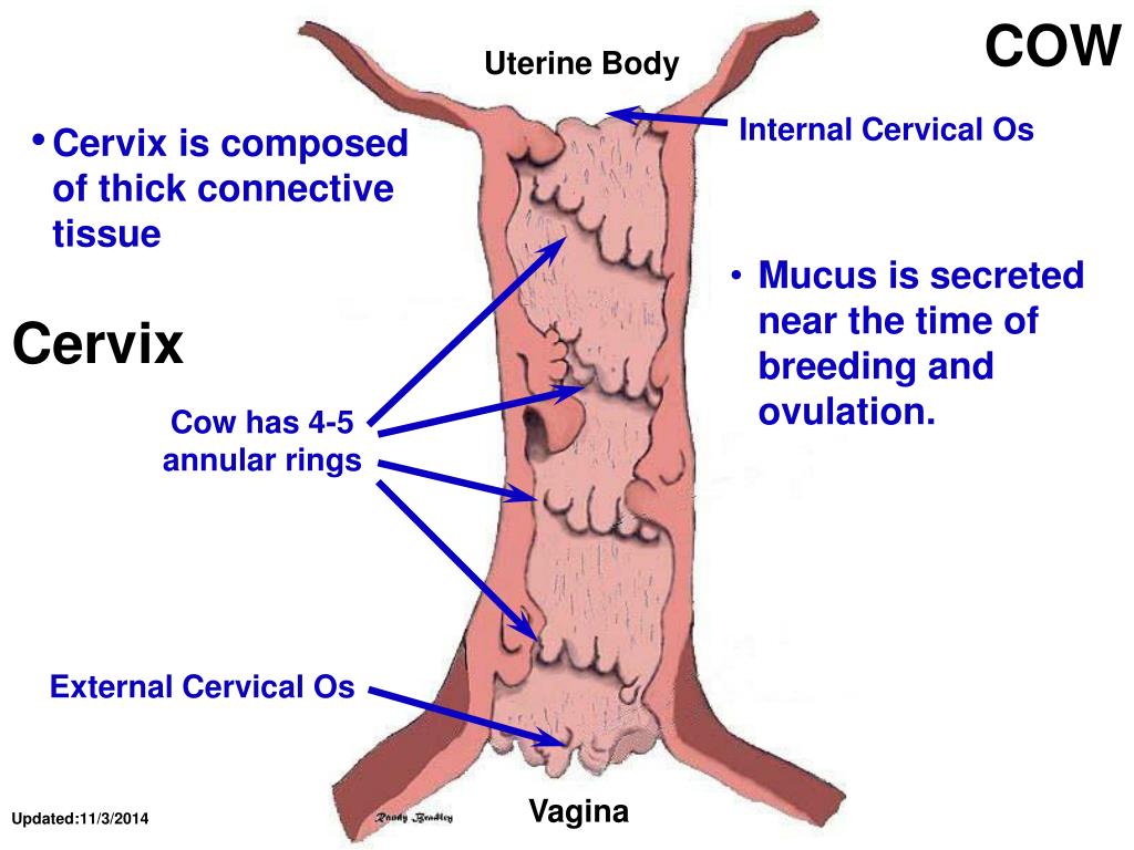 Malposition of the uterus