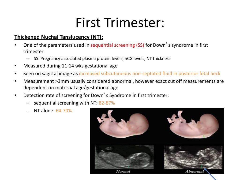 Fetus at first trimester