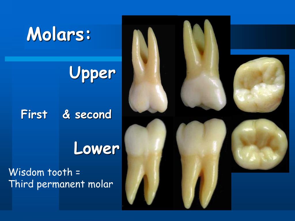 Partial molar pregnancy symptoms