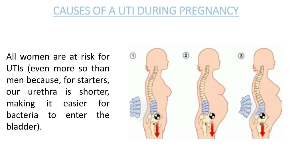 Urine infection pregnant symptoms