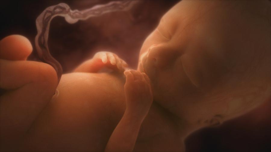 Video of 18 week baby in the womb