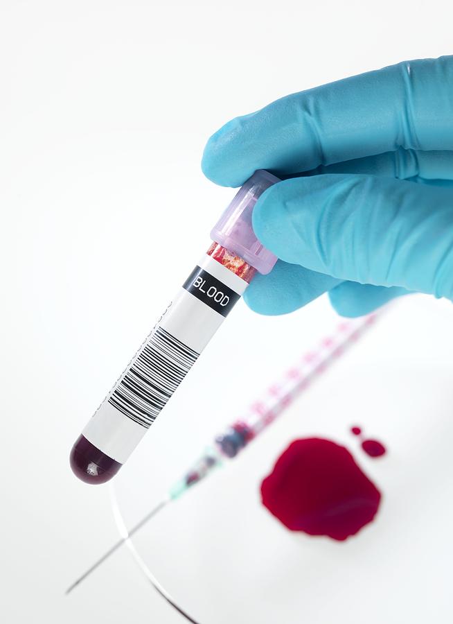 Blood test for newborns