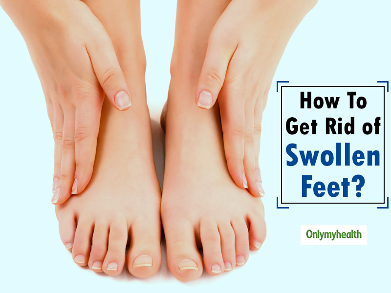 How to reduce swelling in legs and feet during pregnancy