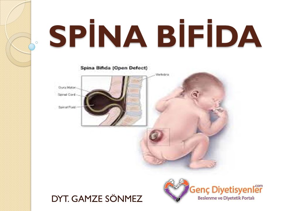 Does spina bifida affect the brain