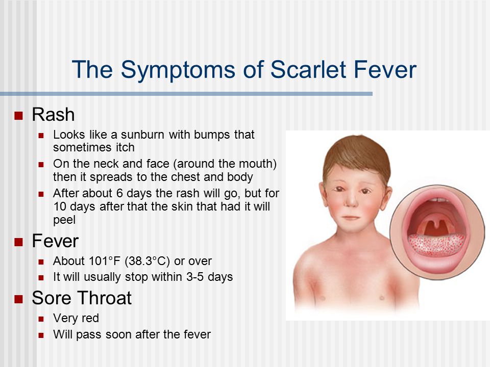 Rashes after fever in infant