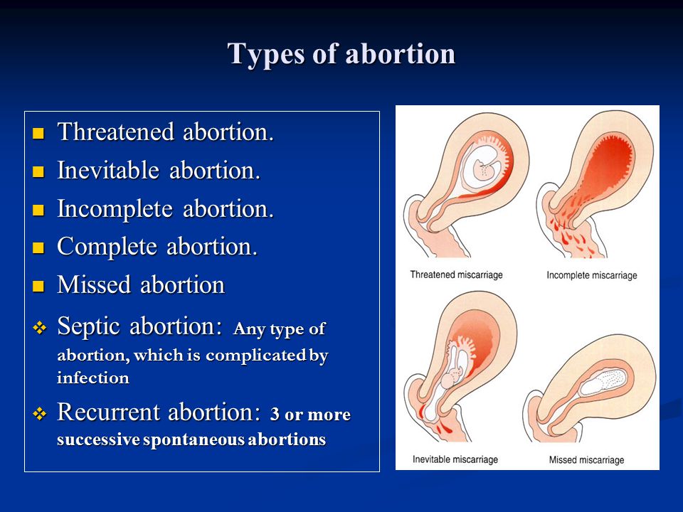 Symptoms of threatened miscarriage