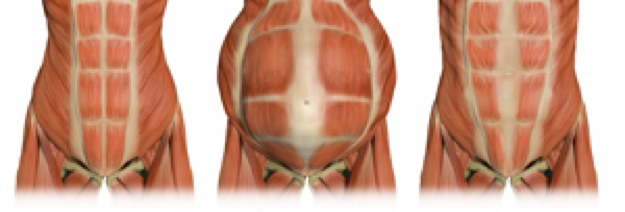 Abdominal muscle separation post pregnancy