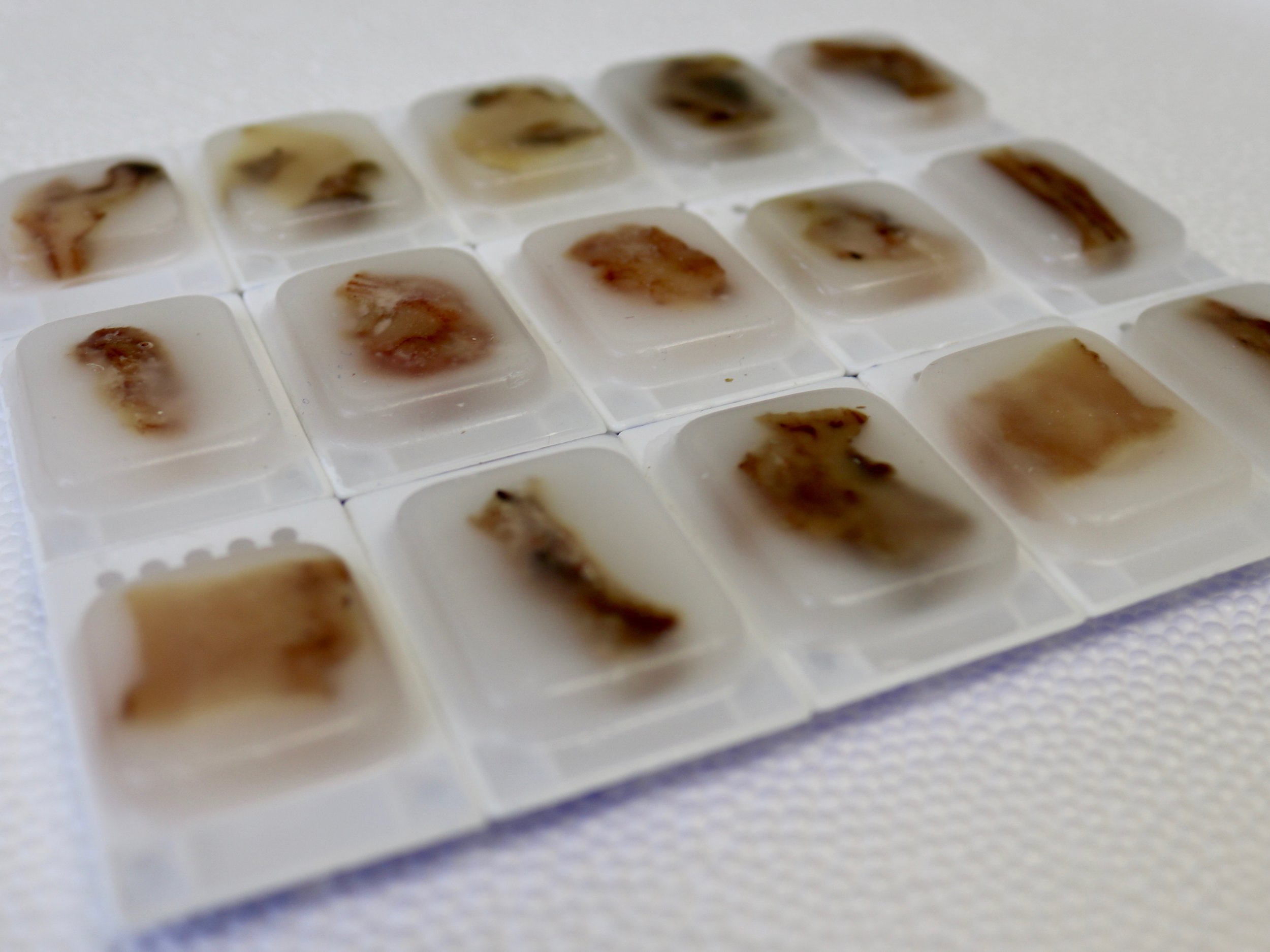 Photos of miscarriage tissue