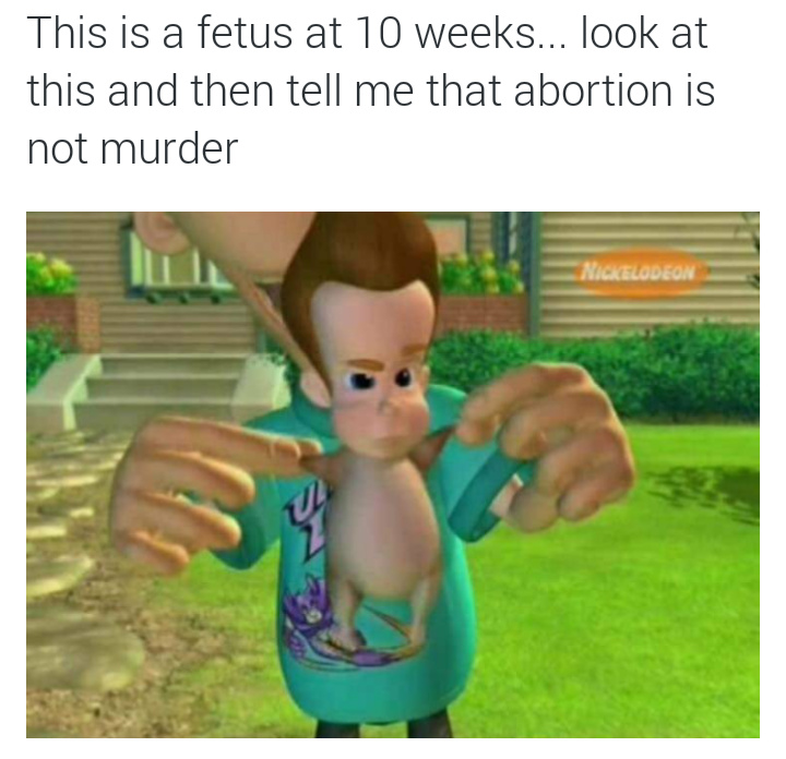 12 week human fetus