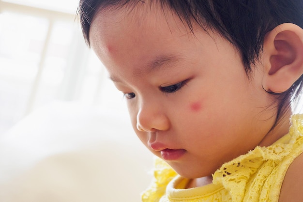 Baby with red spots on face