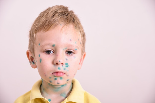 Bumps rash on face child