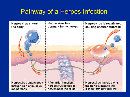 Herpes medicine while pregnant