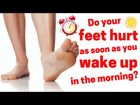 Swollen feet when i wake up