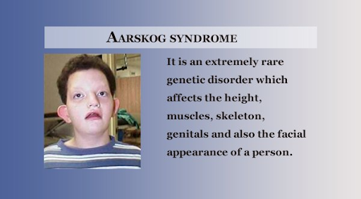 Is down syndrome genetic disorder