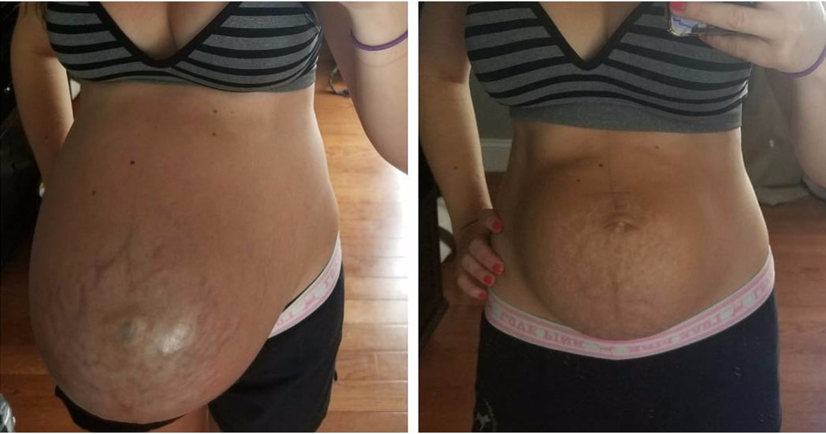 Before and after birth