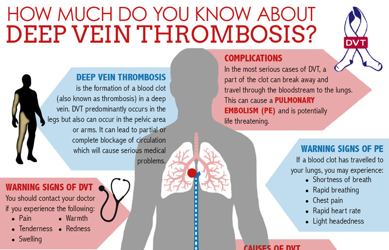 Blood clots in vomit during pregnancy