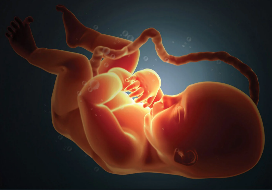 Multiple fetus pregnancy