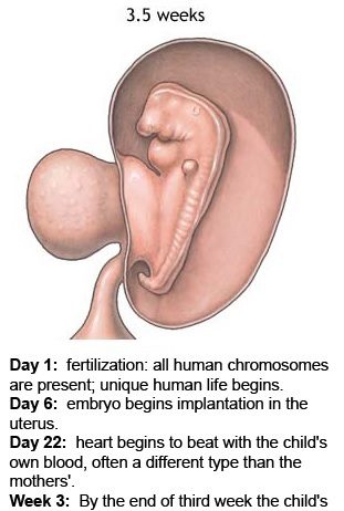 Symptoms of dead fetus in first trimester