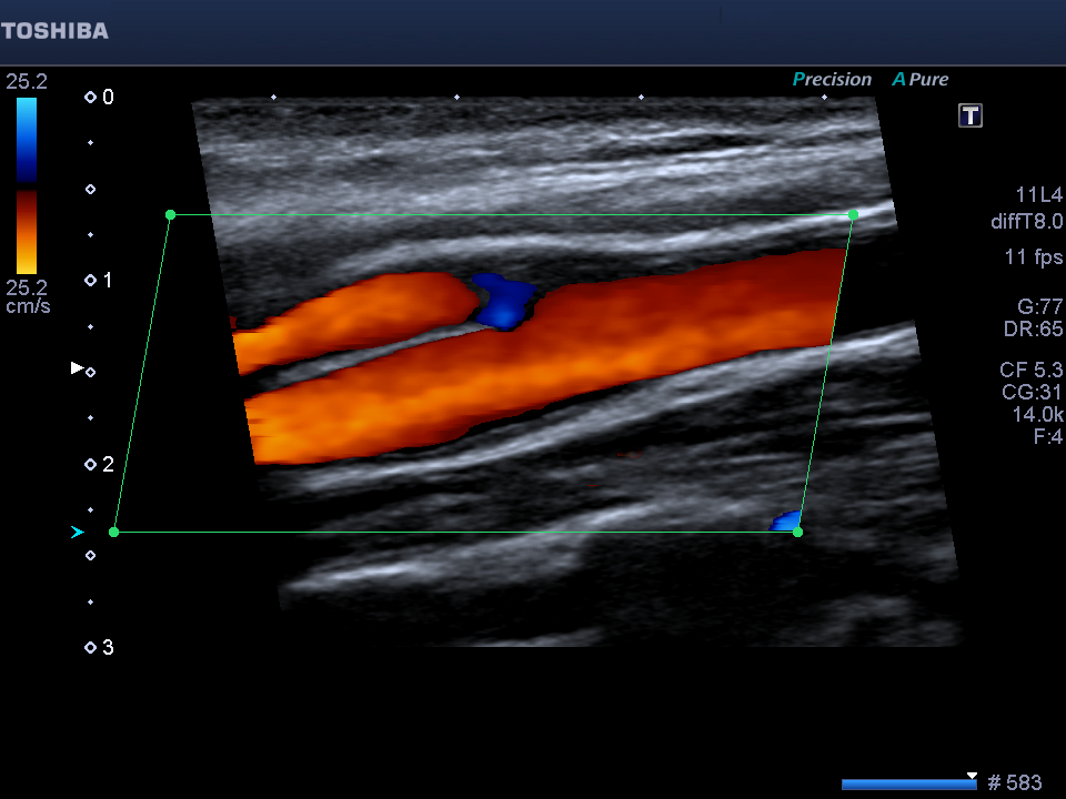 Dating ultrasound accuracy