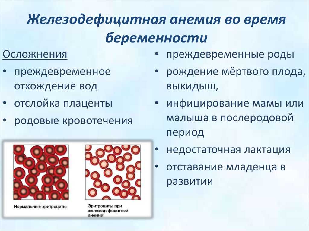 Anemia complicating pregnancy