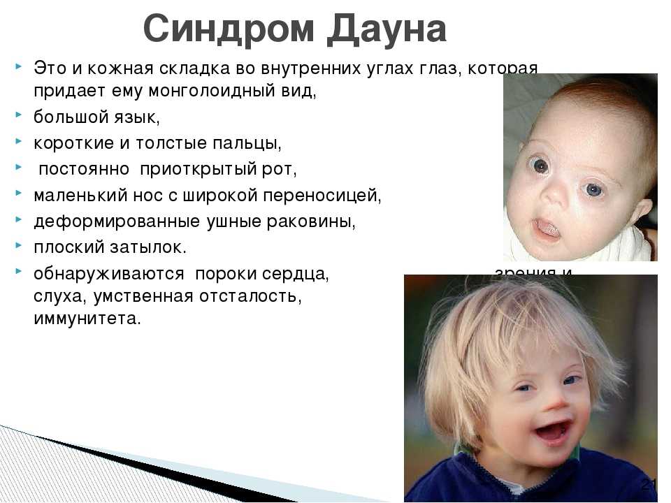 Down syndrome lab test