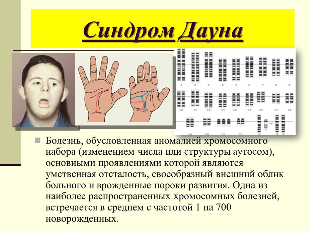 Triple screening for down syndrome