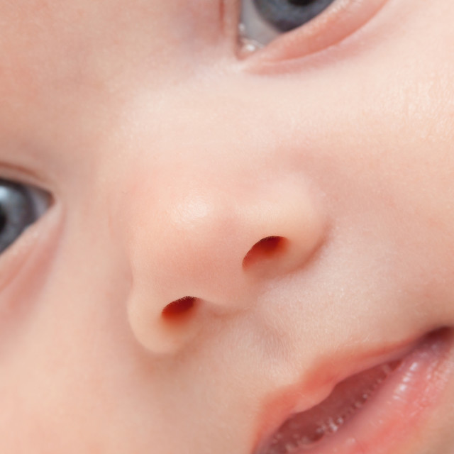 Mucus in newborn eye