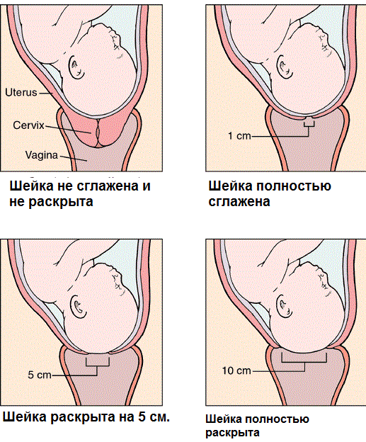 Uterus on period vs not