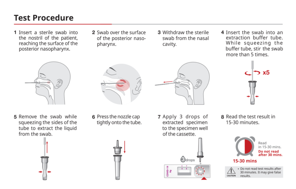 Swab for strep b in pregnancy