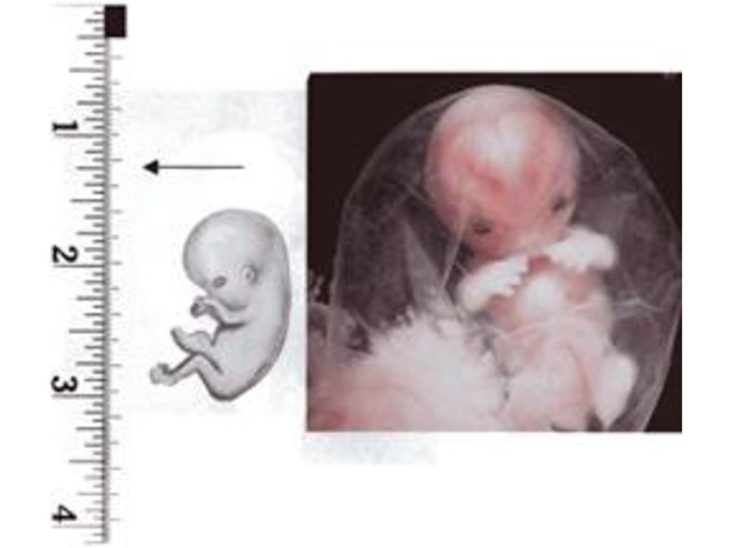 What does a 10 week old fetus look like