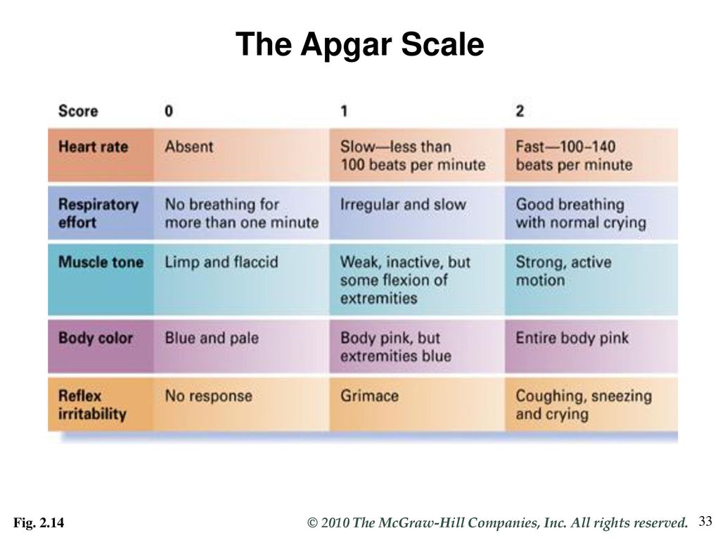 Apgar score of 2