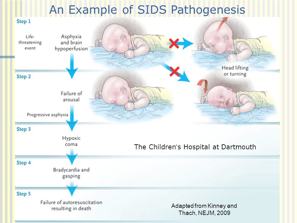 Infants sun exposure