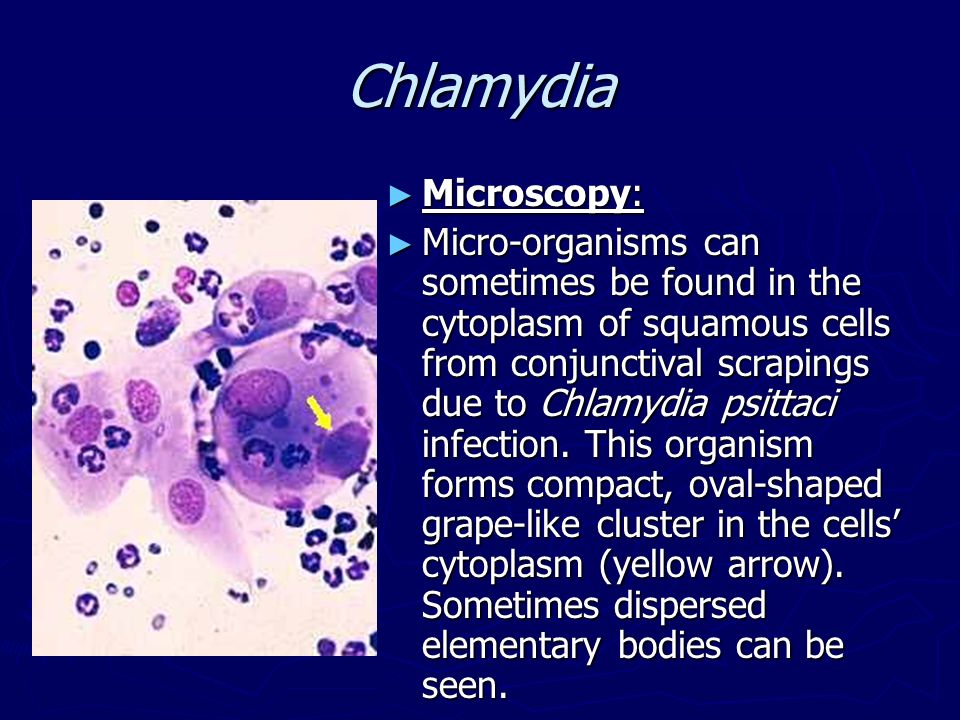 Chlamydia test pregnancy