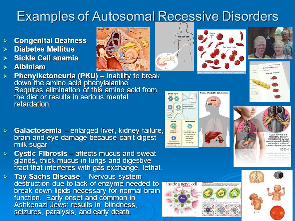 Genetic and congenital disorders