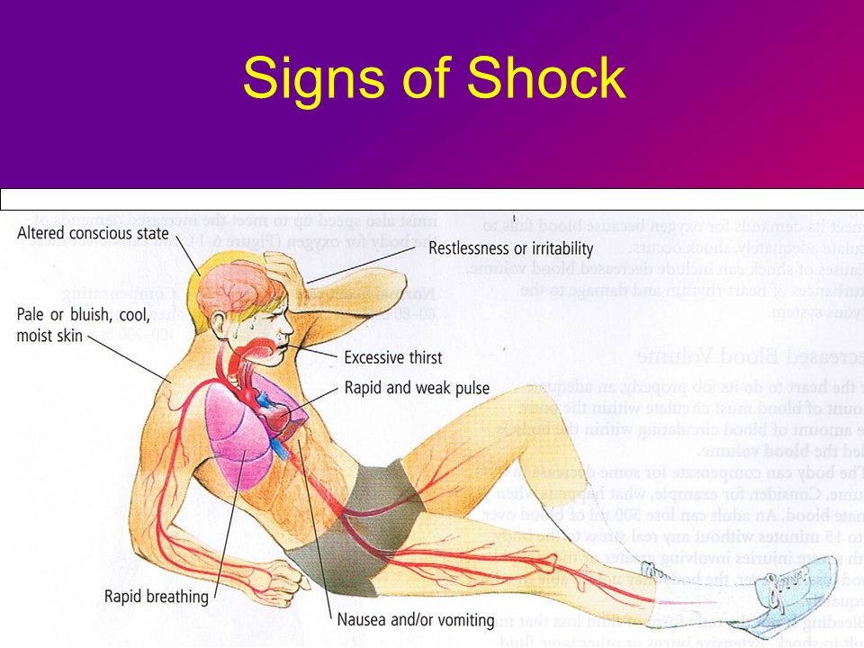 Causes of sunken fontanelle