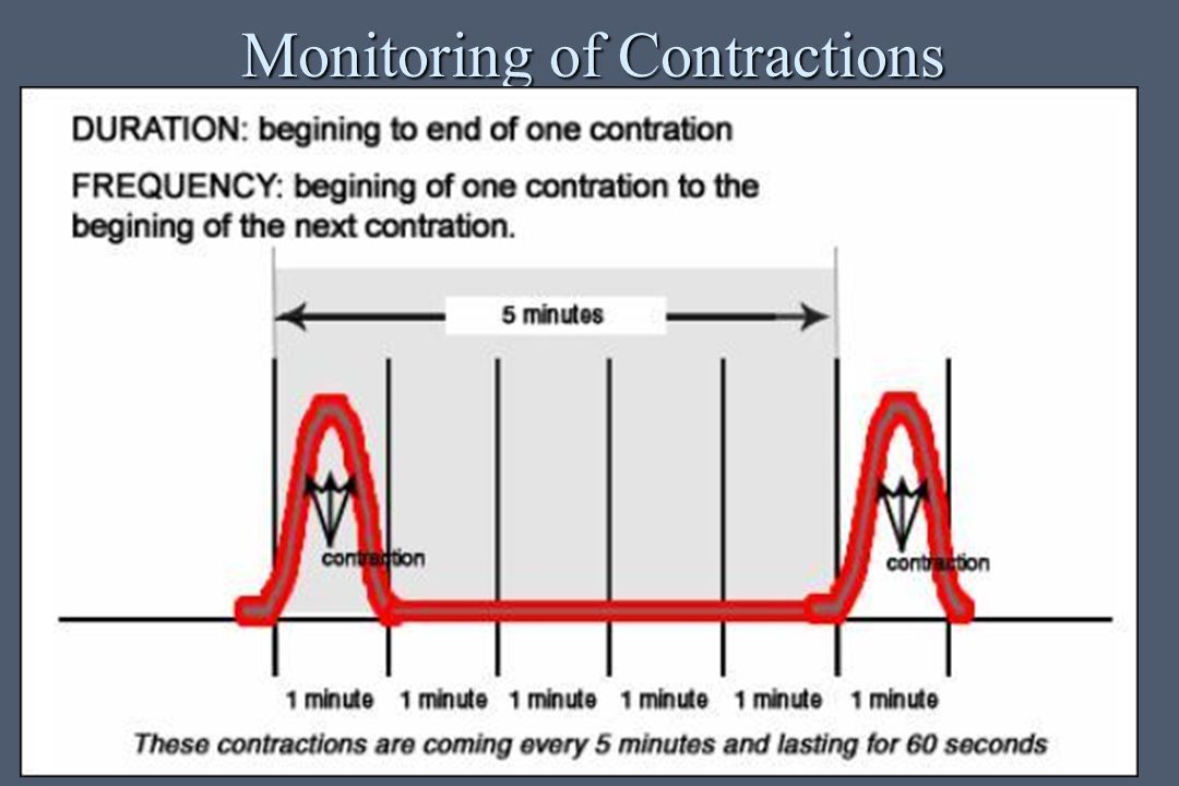 Contraction and dilation