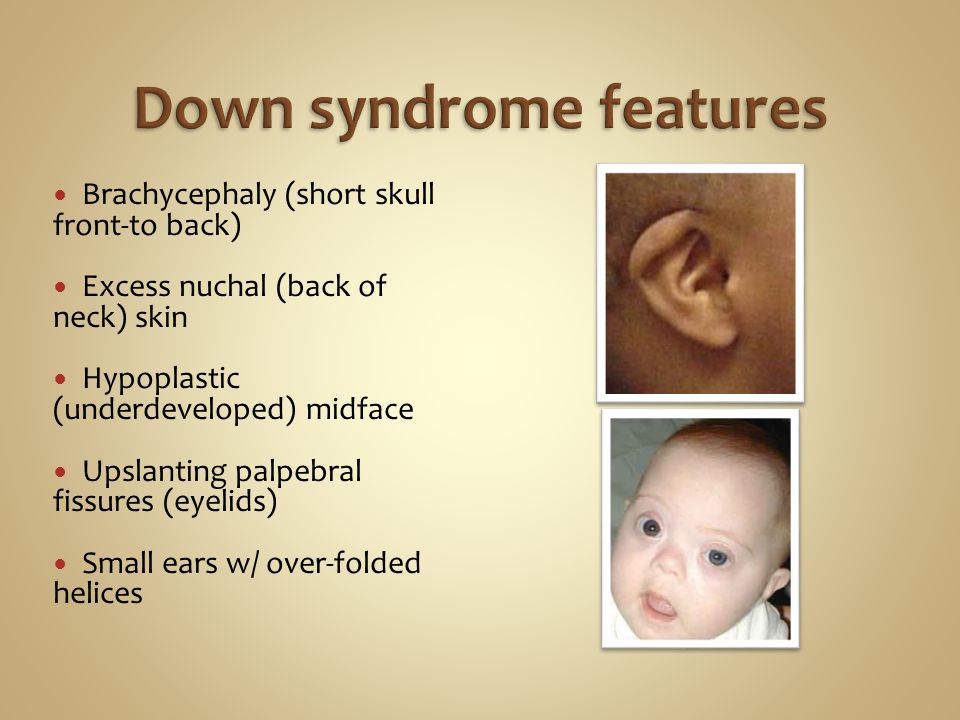 Down's syndrome screening results