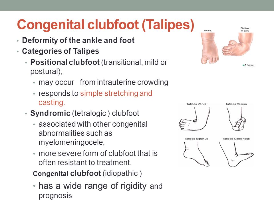 congenital-abnormalities-list