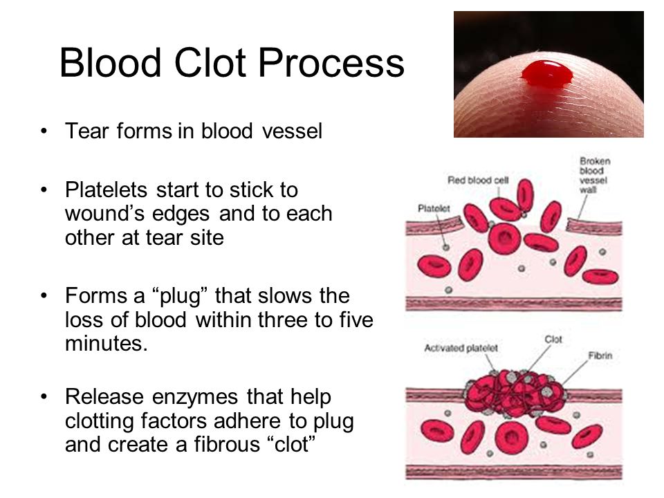 Miscarriage blood clot in toilet
