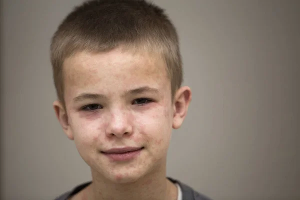 How long is a child with chickenpox contagious