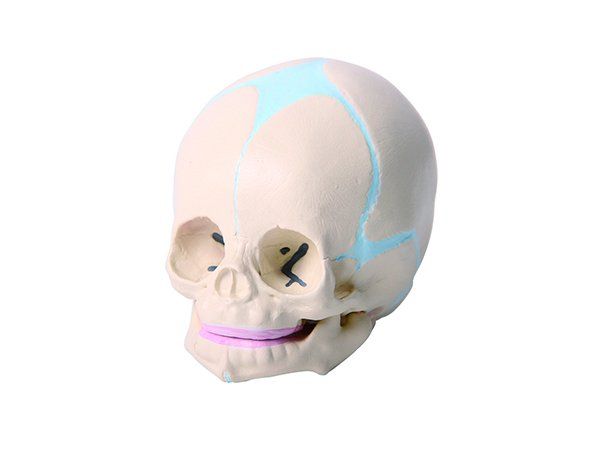 Baby's skull fusing